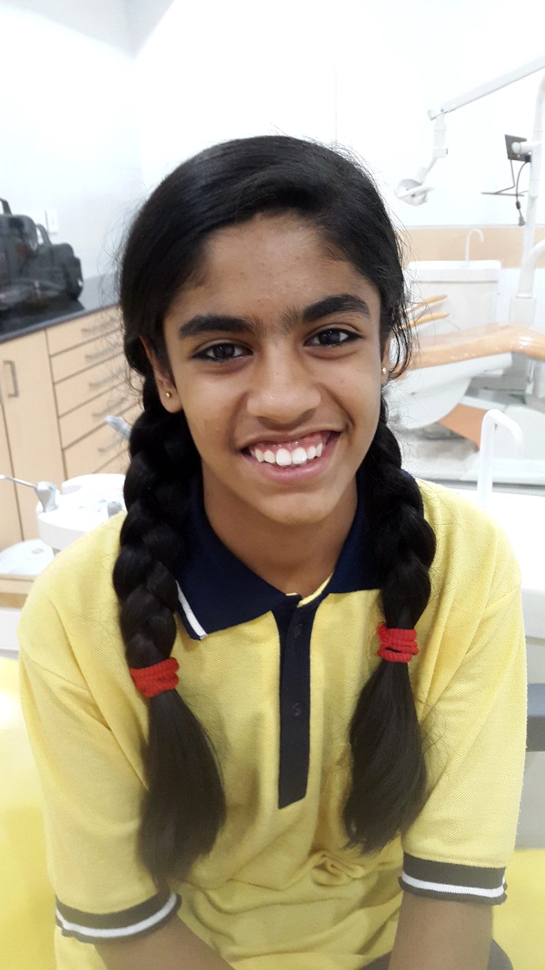 Client smile photo at Star Orthodontist Clinic
