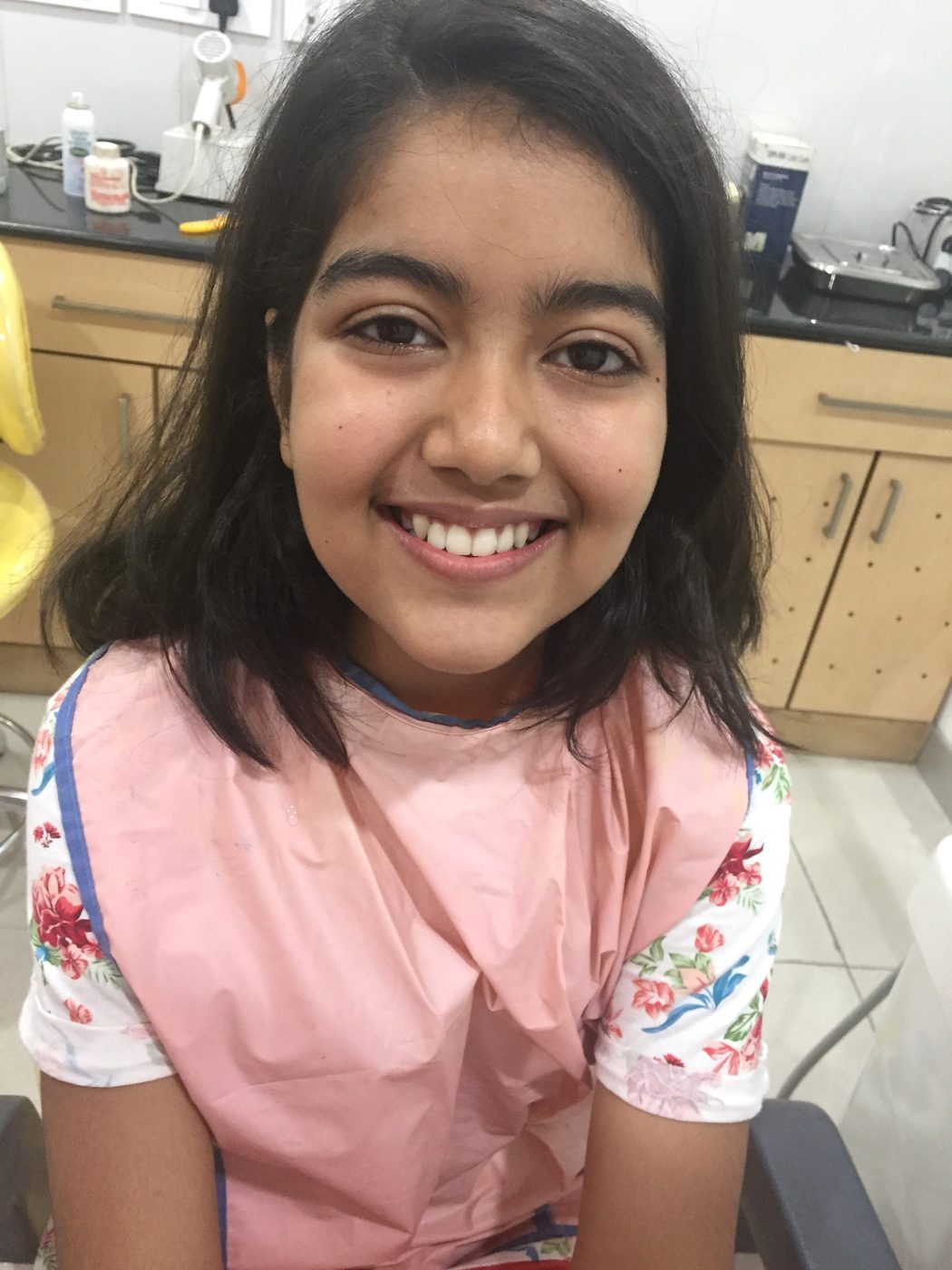 Client smile photo at Star Orthodontist Clinic