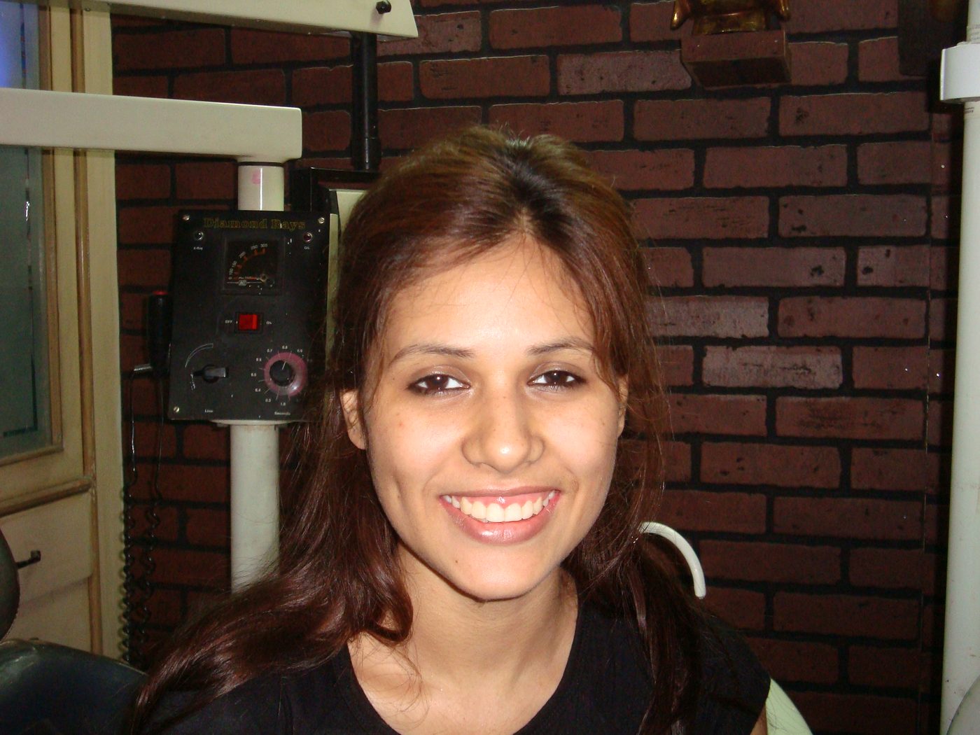 Client smile photo at Star Orthodontist Clinic